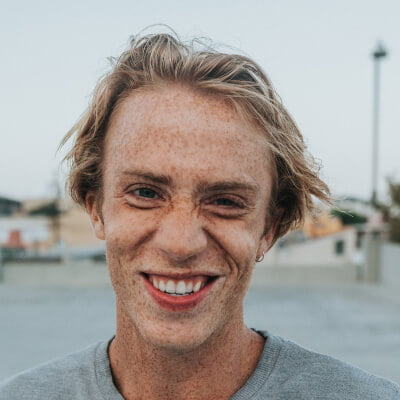 A young man smiling with freckles on his face.