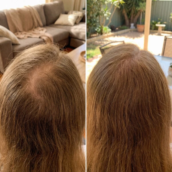 Side-by-side comparison showing the back of a person's head with thinning hair on the left and visibly fuller hair on the right.