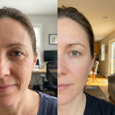 Split-screen image showing the same woman in similar poses; the left side displays more visible wrinkles, while the right side shows smoother skin and even complexion.