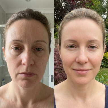 Side-by-side comparison of a woman indoors with a tired expression and uneven skin tone, and outdoors with a brighter complexion and a slight smile.