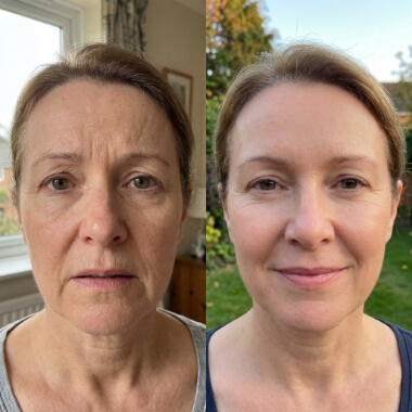 Split image showing the same middle-aged woman indoors with a neutral expression on the left, and outdoors smiling on the right.